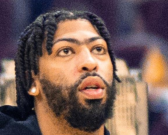 Anthony Davis